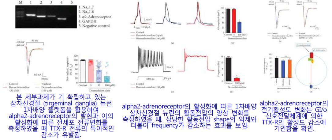 통증변조인자 alpha2-adrenoreceptor의 삼차 입력신경망 특화 신호변조 기전 최초규명