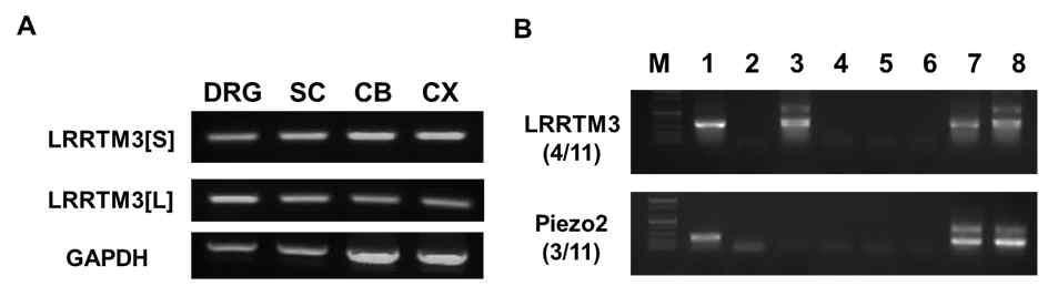 Standard RT-PCR 기법을 통한 말초 및 중추신경계 내에서 LRRTM3 발현 확인 (A) 유전자 수준에서 LRRTM3가 척수신경망에서 발현하고 있음을 확인하였음. (B) LRRTM3가 기계적 통증 발생에 기여하는 Piezo2 channel과 척수후근절 신경세포에서 co-expression되는 것을 확인하였음