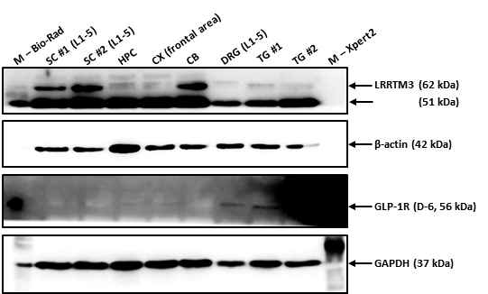 Western 기법을 통한 LRRTM3 단백질 발현 확인 말초, 중추신경계의 주요 조직에서 LRRTM3의 단백질 발현량을 확인하였음. {Spinal cord (SC), Hippocampus (HPC), Cerebral Cortex (CX), Cerebellum (CB), Dorsal Root Ganglion (DRG), Trigeminal Ganglion (TG)}