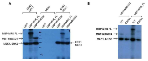 MRS의 phosphorylation. (A) MEK1, ERK1, ERK2에 의한 MRS full-length와 GST-fold 도메인의 인산화 (B) MRS wild type과 S209A mutant의 ERK2에 의한 인산화