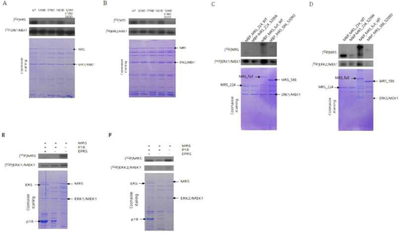 MRS mutant 및 MRS 복합체 단백질의 인산화. MRS 의 Wild type 과 ERK에 의해 인산화 되는 자리인 S209, S799, S825 자리를 serine에서 Aspartic acid 로 치환시킨 단백질 들의 인산화 관측함. A. ERK1에 의한 pET30a-MRS Full mutant 의 인산화, B. ERK2에 의한 pET30a-MRS Full mutant 의 인산화, C. ERK1에 의한 pMALhis tagged MRS 인산화, D. ERK2에 의한 pMALhis tagged MRS 인산화. E. ERK1에 의한 MRS-AIMP3, MRS-AIMP3-ERS 복합체의 인산화, F. ERK2에 의한 MRS-AIMP3, MRS-AIMP3-ERS 복합체의 인산화