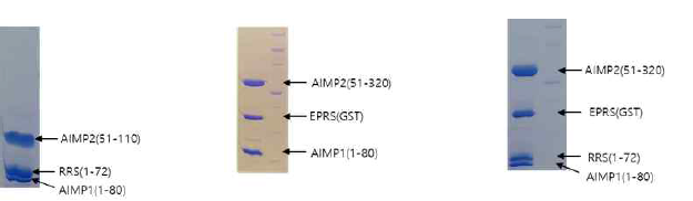 Leucine zipper 단백질의 복합체 정제 2. AIMP1과 AIMP2, RRS complex에 추가로 AIMP1-AIMP2-EPRS complex와 RRS-AIMP1-AIMP2-EPRS의 결정체 스크리닝을 위한 정제