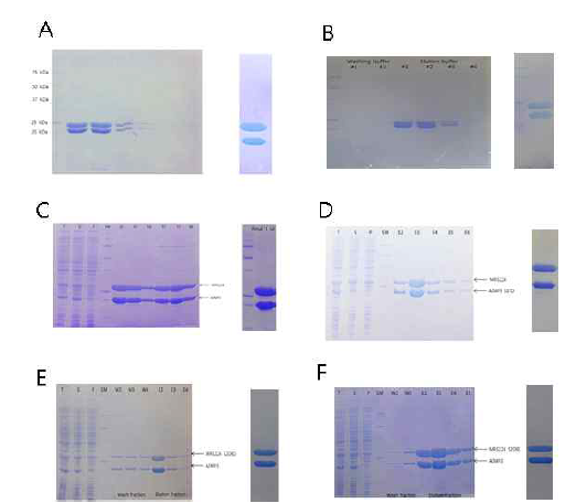 MRS GST domain 과 AIMP3 단백질의 복합체의 co-purification 및 최종 단백질 SDS PAGE. A. MRS207 과 AIMP3(1 to 169) T42MI70MK96M mutant 복합체, B. MRS207 과 AIMP3 S87D mutant 복합체, C. MRS224 과 AIMP3 C147S 복합체, D. MRS224 과 AIMP3 S87D mutant 복합체, E. MRS224 S209D mutant와 AIMP3 C147S mutant 복합체, F. MRS224 S209E mutant와 AIMP3 C147S mutant 복합체. T : Total, S : Soluble, P : Pass, SM : Protein Size marker, W : Washing fraction, E : Elution fraction