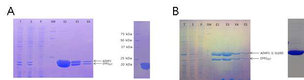 AIMP3 와 EPRS GST domain 단백질의 복합체의 co-purification 및 최종 단백질 SDS PAGE. A. AIMP3와 EPRS GST domain (1 to 175) C92SC105SC123S mutant 복합체, B. AIMP3 (1to169) 와 EPRS GST domain (1 to 175) C92SC105SC123S mutant 복합체. T : Total, S : Soluble, P : Pass, SM : Protein Size marker, E : Elution fraction