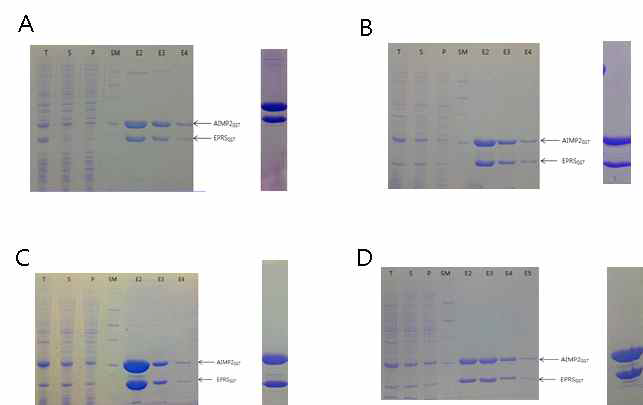 EPRS GST domain 과 AIMP2 GST domain 단백질의 복합체의 co-purification 및 최종 단백질 SDS PAGE. A. EPRS GST domain (1 to 163 add 31 a.a) 과 AIMP2 GST domain (111 to 320) 복합체, B. EPRS GST domain (1 to 175)와 AIMP2 GST domain (90 to 320) 복합체, C. EPRS GST domain (1 to 175) C92SC105SC123S mutant 와 AIMP2 GST domain (90 to 320), D. EPRS GST domain (1 to 175) C92SC105SC123S mutant 와 AIMP2 GST domain (90 to 320) S156D mutant 복합체,. T : Total, S : Soluble, P : Pass, SM : Protein Size marker, E : Elution fraction