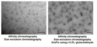 Cryo-EM에 적합한 시료 조건 탐색을 위한 negative staining EM 이미지 분석