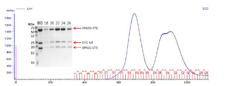 DX2 full-KRS(66-579)-EPRS(1-175) triple complex의 SEC와 SDS_PAGE 결과