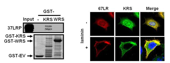 GST-KRS와 LR의 pull-down(좌), A549cell 안에서 KRS와 LR의 localization(우)