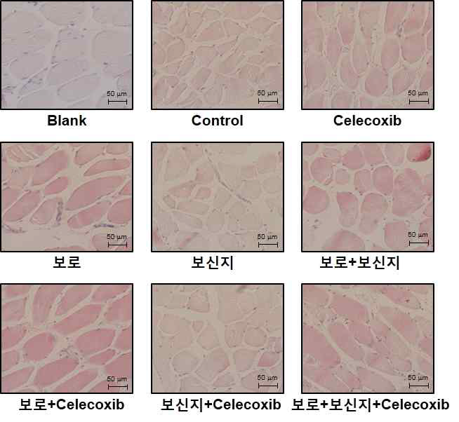 암성 악액질 동물모델에서 보로와 보신지 투여에 의한 Gastrocnemius 근육의 H&E 염색