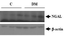 신장질환동물모델의 신장조직에서의 NGAL의 발현 변화