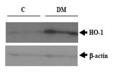 신장질환동물모델의 신장조직에서의 HO-1의 발현 변화