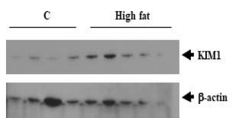 신장질환동물모델의 신장조직에서의 KIM1의 발현 변화
