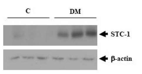 신장질환동물의 신장 조직에서 변화하는 miRNAs의 표적유전자인 STC-1의 발현 변화