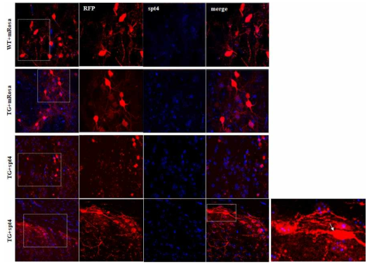 AAV-Spt4-RFP ST투여한 YAC128마우스의 Striatum에서 면역염색법을 이용하여 세포 내에 RFP 발현과 Spt4의 감소 여부 확인 (화살표)