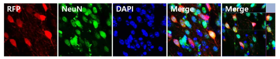 AAV-Spt4-RFP ST투여한 YAC128마우스의 Striatum에서 면역염색법을 이용하여 신경세포 내의 RFP 발현 여부 확인