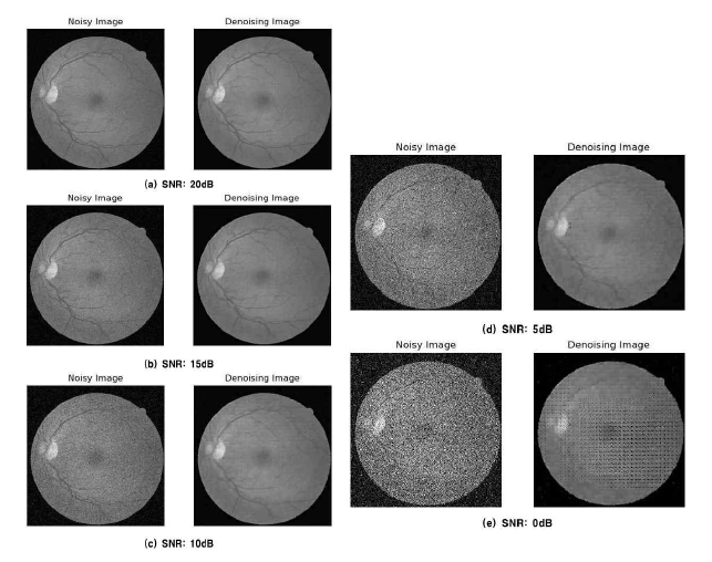 오토인코더 신경망을 활용한 망막 영상의 잡음제거 결과
