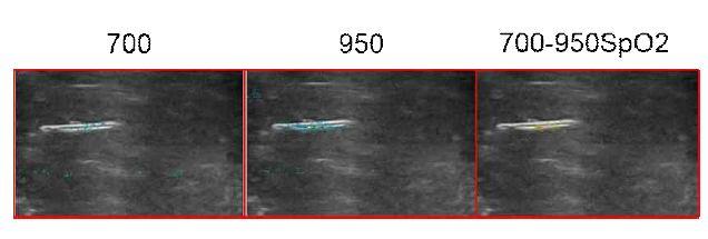 750, 950nm 파장을이용하여 얻은 상대적 산소포화도 영상