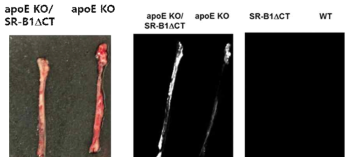 Ex vivo image of the thoracic aorta of mice. Top image is pathologic specimen. Bottom images are NIR image after