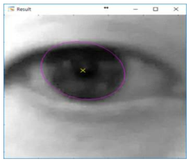 Iris detection in this work using Swirski algorithm