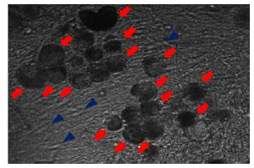 인간 후근 신경절 세포 및 교세포 공동배양 (화살표 : 후근 신경절 세포, 화살표 머리 : 교세포)