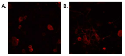 마우스 후근 신경절 세포 돌기 변화 확인 A) 배양 후 0일 째, B) 배양 후 3일 째의 후근 신경절 세포