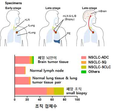 폐암 연구 코호트 개요 및 샘플 현황