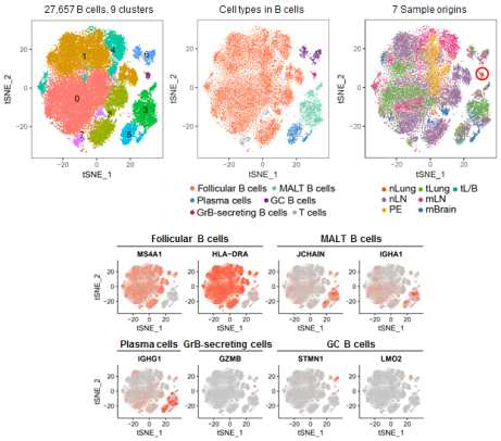 B 림프구의 특성 분류 및 B cell subset 마커 발현
