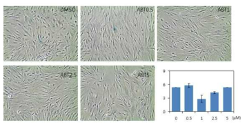 ABT263의 골수유래 중간엽줄기세포의 노화에 미치는 영향