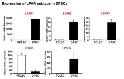 치주인대줄기세포(PDLSC)와 치수줄기세포(DPSC)에서 LPAR 발현 확인