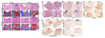 쥐 치수 재생모델에서 3일, 5일 경과 후 H&E, MTC(왼쪽) 및 면역 염색(오른쪽) 결과