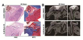 쥐 상아질 재생모델에서 6주 후 HE & MTC 염색(왼쪽) 및 microCT(오른쪽) 결과