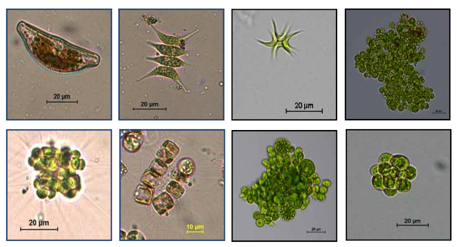 고체배지에서 분리한 미세조류 현미경 사진(x200, x400)