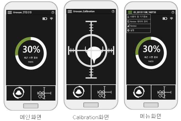 전립선증 임상활용 모델의 UI