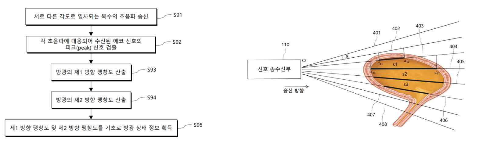 방광 충만도 추정 알고리즘