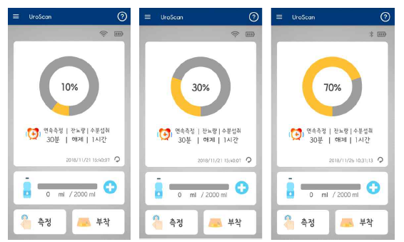 2차 사용자 프로그램에서의 방광 측정 결과 화면