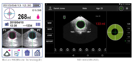 초음파 방광용적 측정기의 측정화면 예시