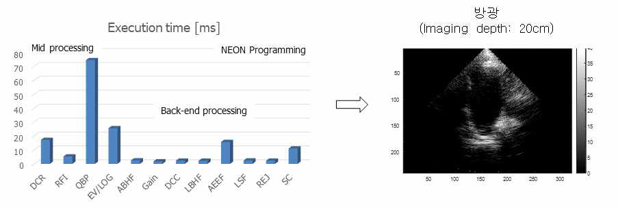 방광 모니터링 기기의 초음파 신호 및 영상처리 블록의 Zynq-7020내 Processing System에 NEON를 이용하여 구현한 결과