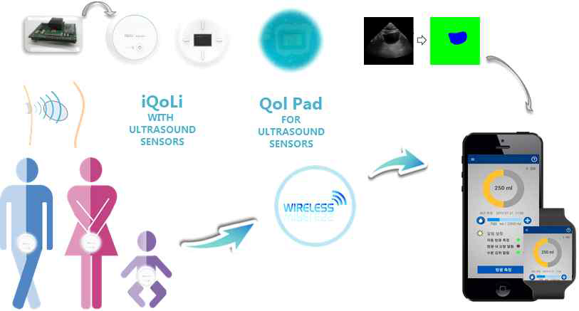 개발된 패치형 초음파 방광 모니터링 헬스케어 시스템 기술 요약