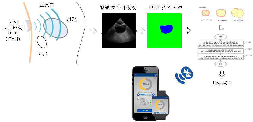 패치형 초음파 방광 모니터링 기기를 활용한 방광 용적 측정 기술