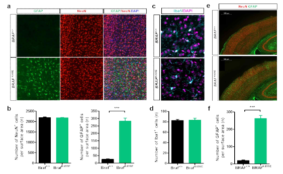 신경 줄기 세포 특이적 BRAFK499E 발현이 분화에 미치는 영향 (전뇌 피질) a 체성감각 피질에서 성상세포, 신경세포의 발현 b 신경세포 마커인 NeuN, 교세포 마커인 GFAP 세포의 숫자 c 체성감각 피질에서 미세아교세포의 발현 d 미세아교세포 마커인 Iba1 세포의 숫자 e 제2 청각 피질에서 성상세포의 발현 f 성상세포 마커인 GFAP 세포의 숫자