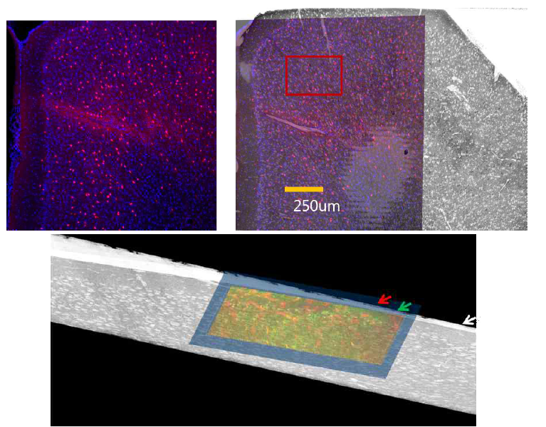 (위)PV+ 인터뉴런에만 선택적으로 형광을 발현하는 PV-ai9 생쥐의 전전두피질. 광학현미경 영상과 전자현미경 저배율 영상 간 연계성 찾음 (ACC 영역). 붉은 색 상자가 고배율 연속영상 데이터를 확보한 영역임. (아래)이광자 형광현미경 이미지와 EM이미지의 병합
