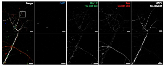 면역염색을 통한 초대배양 신경세포에서 Cav1.2 항체의 검증