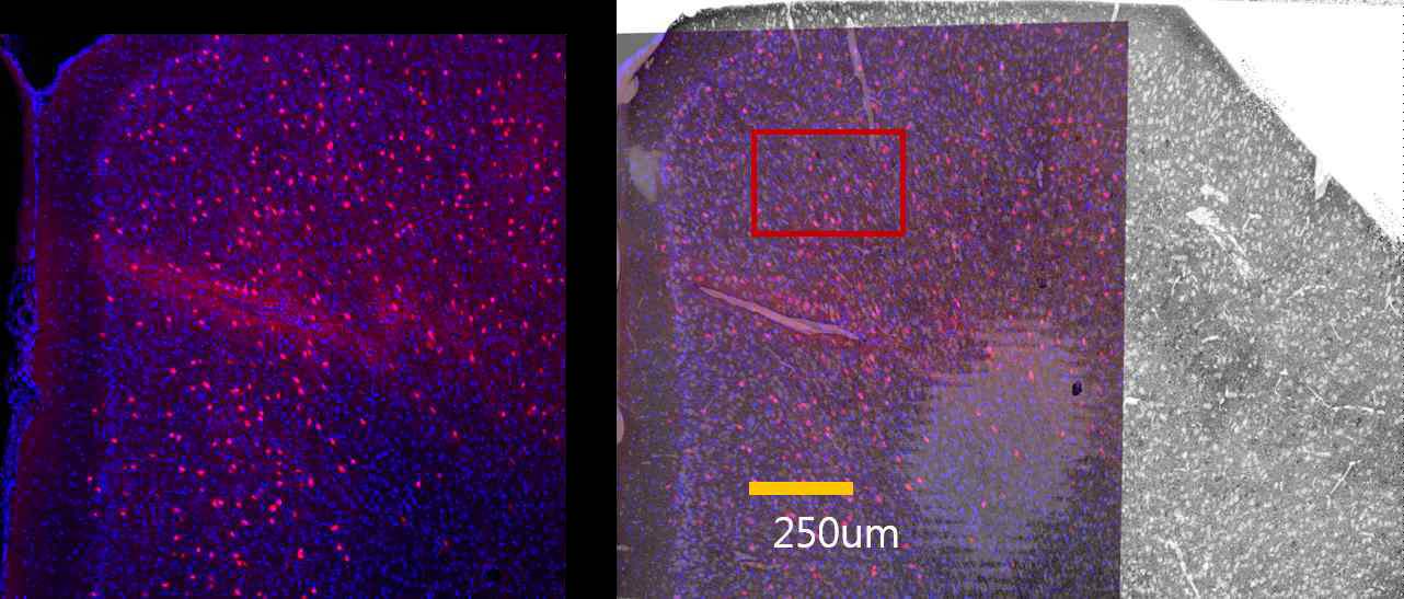PV+ 인터뉴런에만 선택적으로 형광을 발현하는 PV-ai9 생쥐의 전전두피질. 광학현미경 영상과 전자현미경 저배율 영상 간 연계성 찾음 (ACC 영역). 붉은 색 상자가 고배율 연속영상 데이터를 확보한 영역임