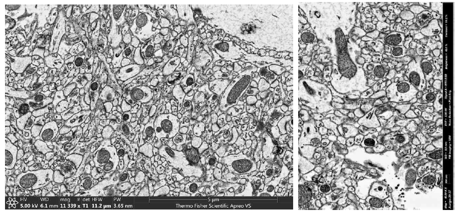 병렬이미징 참여기관에서 획득한 고배율 EM 영상. 5 nm/pixel의 고해상도 이미지로 신경세포 간 시냅스의 연결 관계를 명확히 구분할 수 있음