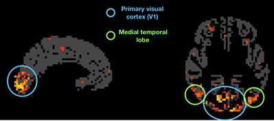 컨볼루션 신경망의 중간 변수로 활동이 유의미하게 예측되는 뇌 영역. 빨간색에서 노란색으로 갈수록 더 기계학습의 중간변수와 활동사이의 상관성이 높은 영역이며 주로 후두부에 위치하는 부분임