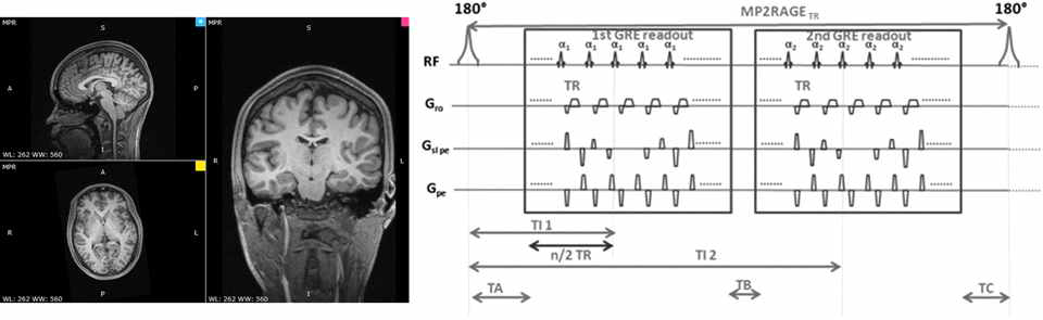 최적화된 T1으로 획득한 영상 및 MP2RAGE Sequence diagram