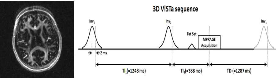 최적화 된 ViSTa-MWI로 획득한 영상(raw data) 및 ViSTa Sequence Diagram