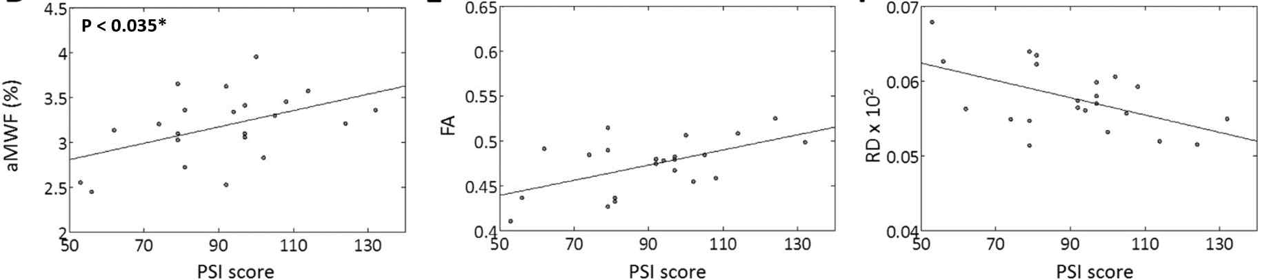 신경수초물분율(aMWF), DTI 지표와 프로세싱속도 인덱스와의 관계. 신경수초물분율과 프로세싱 속도 인덱스와의 상관관계에서 통계적 유의성을 보여줌