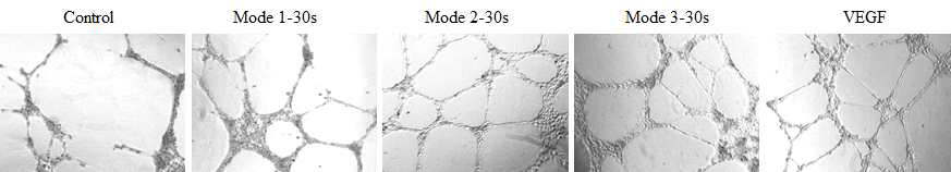 혈관내피세포의 혈관형성능 확인