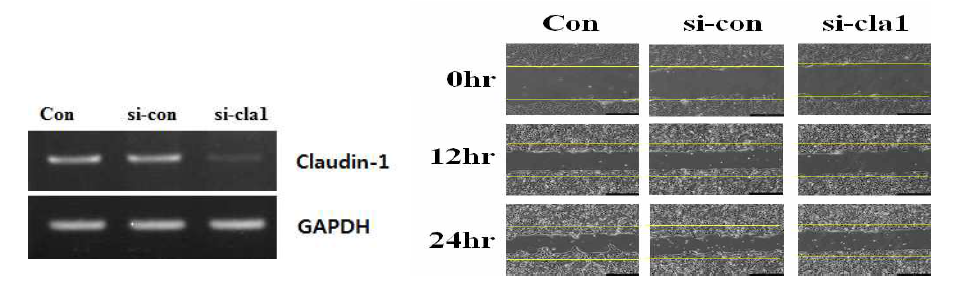 Claudin-1 siRNA transfection한 상피세포의 migration